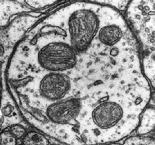 Mitochondria image By NIH (NIH) [Public domain], via Wikimedia Commons