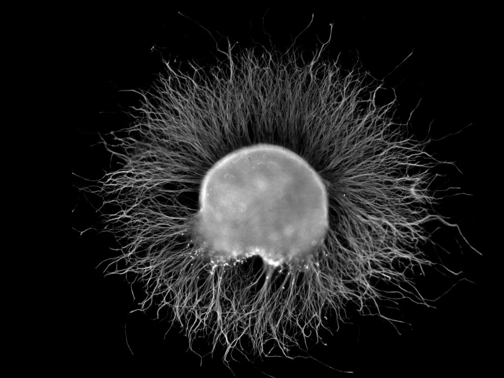 This picture was taken of a chicken embryo nerve cell after it was incubated overnight in a Nerve Growth Factor medium. I think it is cool how the result kind of resembles the appearance of Lion's Mane Mushroom. Dp