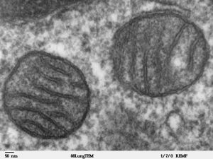 The mammalian mitochondria in all of its glory. By Louisa Howard [Public domain], via Wikimedia Commons